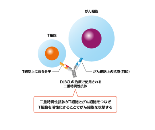 疾患編】びまん性大細胞型B細胞リンパ腫（DLBCL）の治療（二重特異性