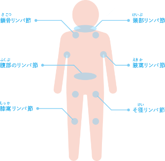 リンパ節